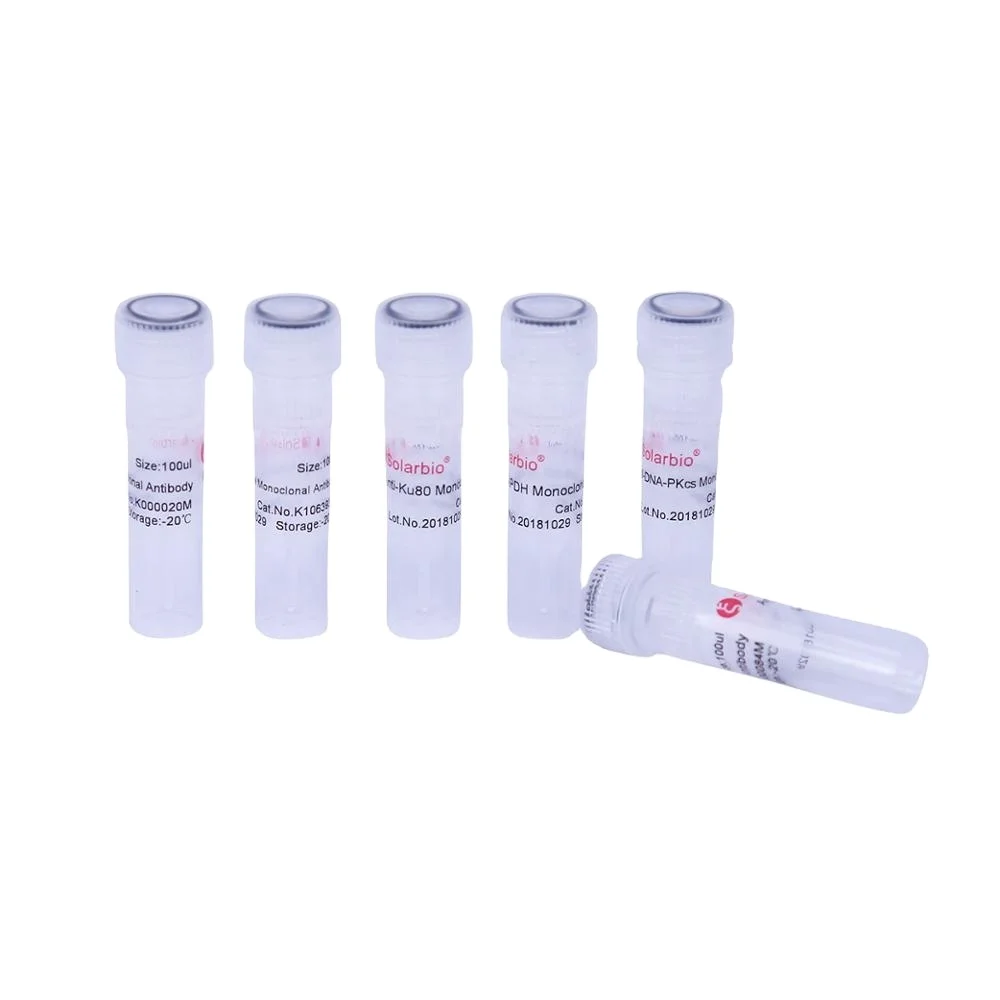 Высокое качество Anti KDM1A моноклональное