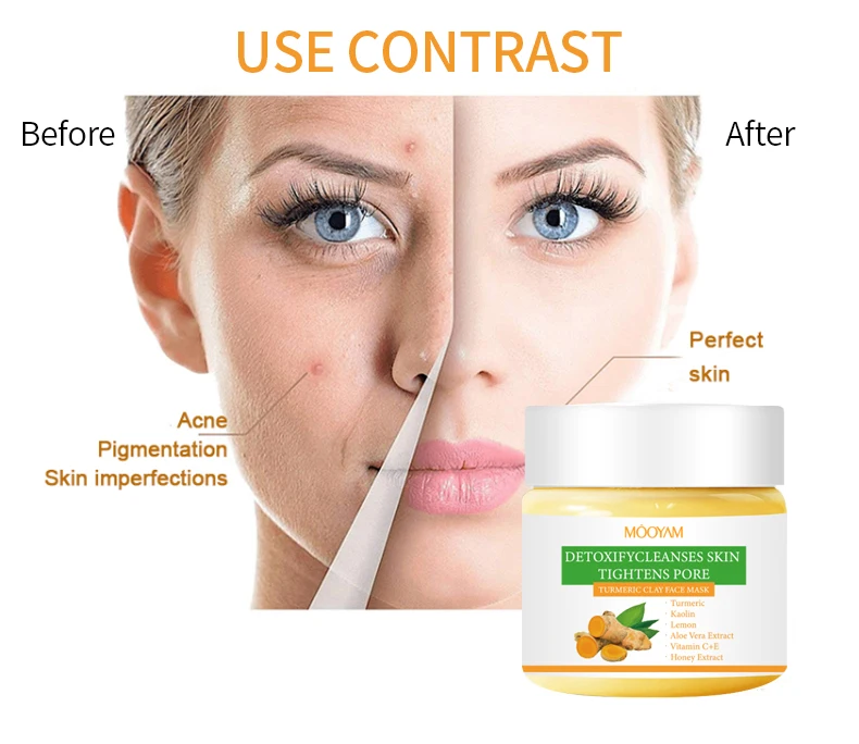 OEM ODM Supplier Ginger Acne Treatment Whitening Mask Lightening Hydrating Anti Wrinkle Turmeric Mud Mask