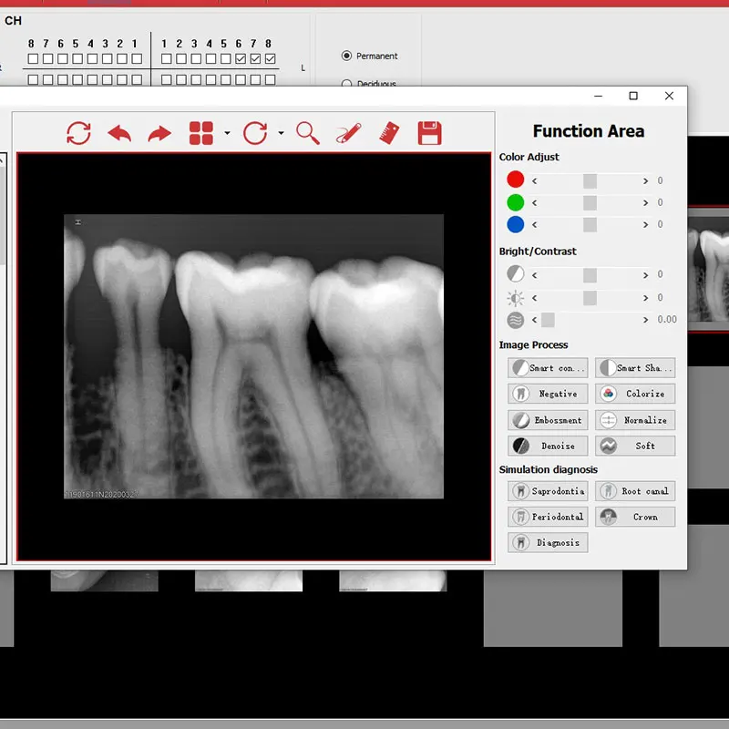 Самый популярный зубоврачебный рентгеновский Датчик CE аппарат портативный цифровой стоматологический датчик