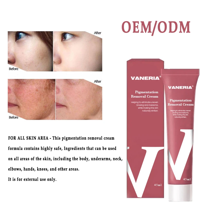 Pigmentation Removal Cream Brightening Skin Nourishing Whitening Organic Dark Spot Remover Bleaching Cream