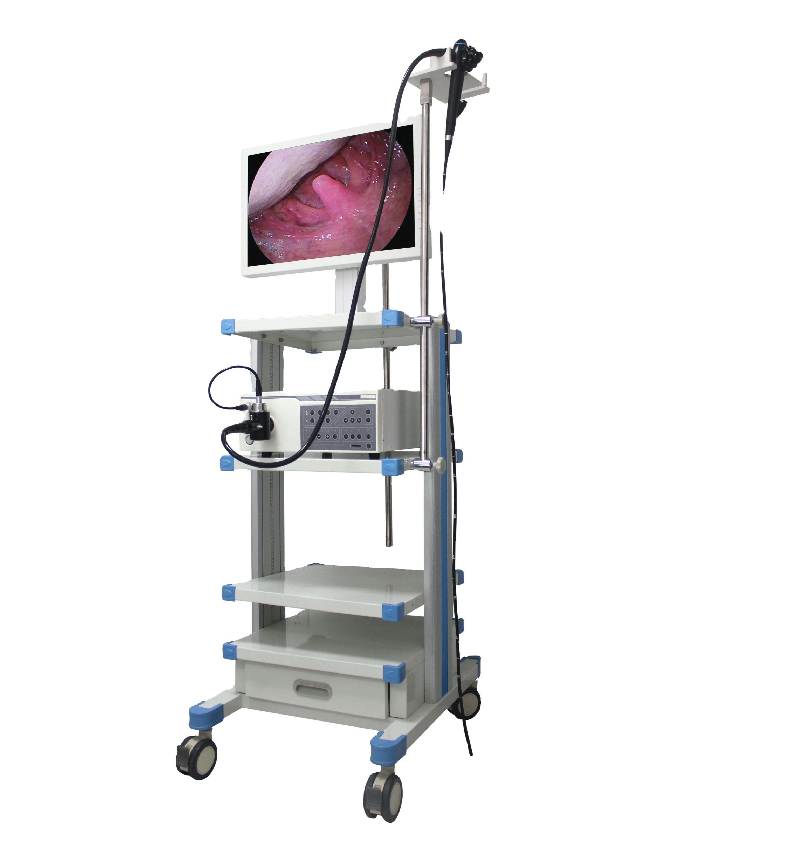Low-Price High Resolution Newly Video Flexible Gastroscopy From Shanghai Manufacturer