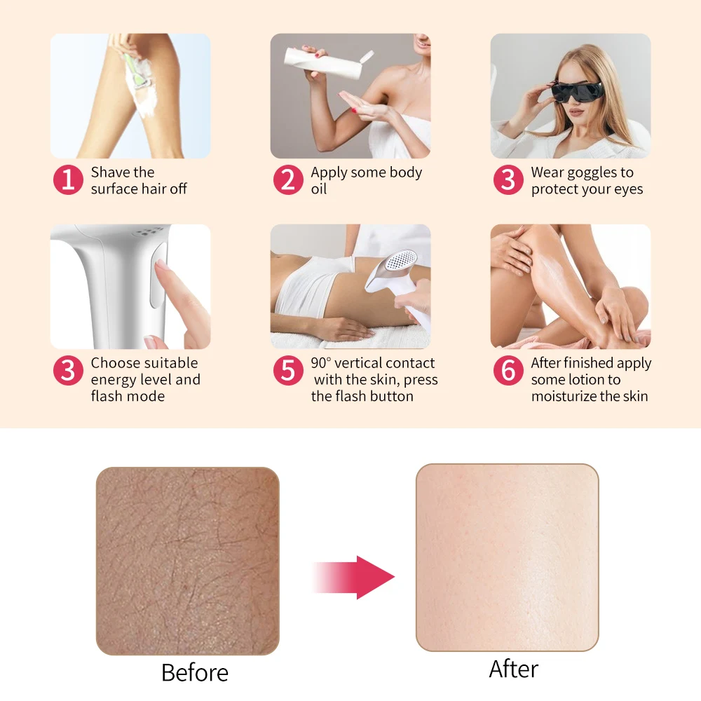 Lescolton T009i IPL Depilador Facial Hair Epilator Permanent Home Use Laser Hair Removal Machine