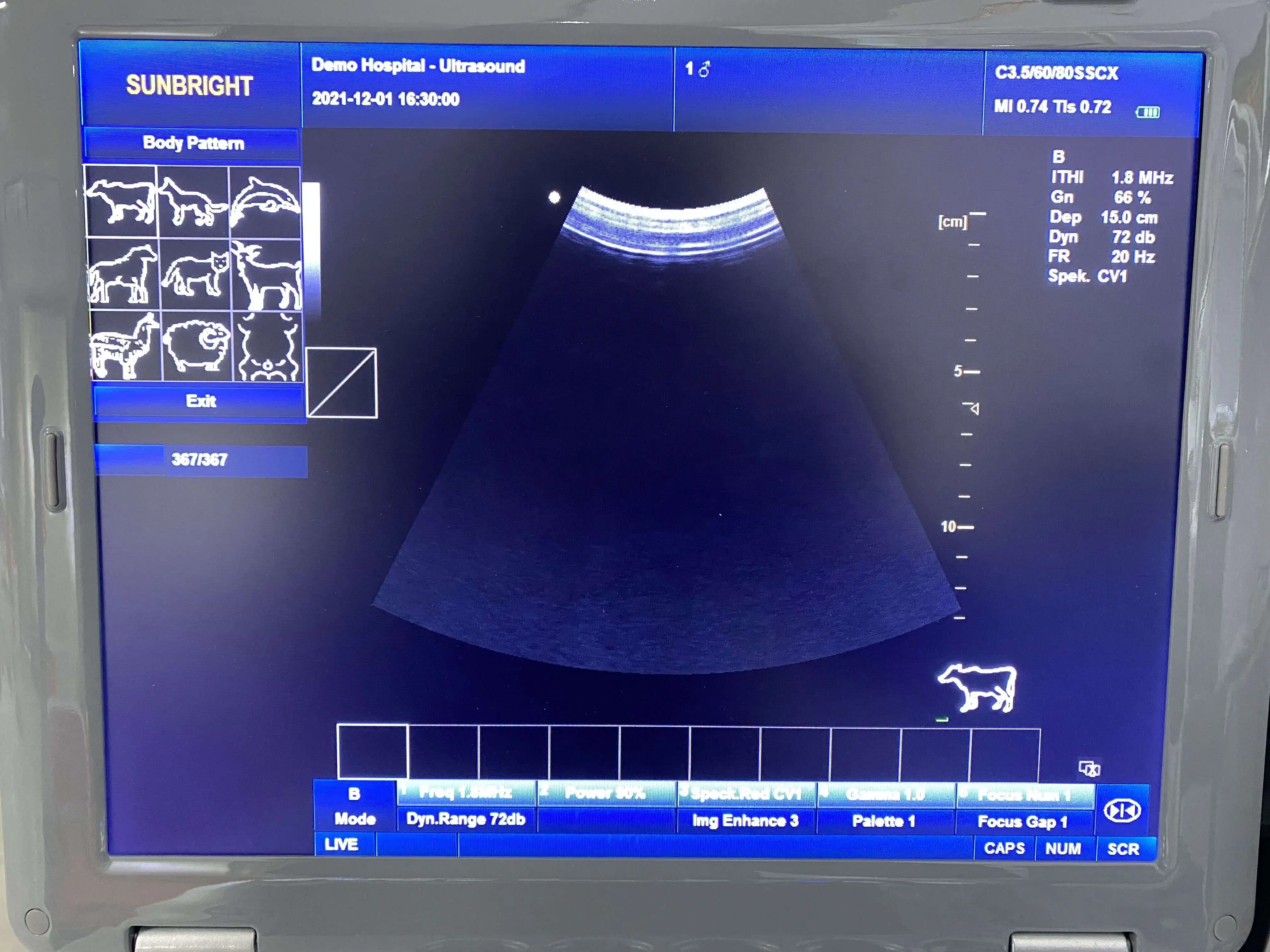 2 set software human and animal use Laptop Ultrasound Scanner Machine with probe