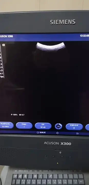 Ультразвуковая цветная доплеровская система Siemens Acuson X300 с выпуклыми линейными зондами TVS