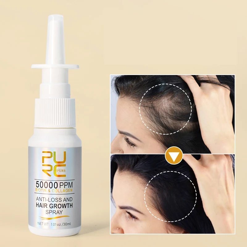 Organic Biotin Collagen Hair-Loss Prevention Anti-Loss Spray Hair Fall Treatment Hair Growth Spray
