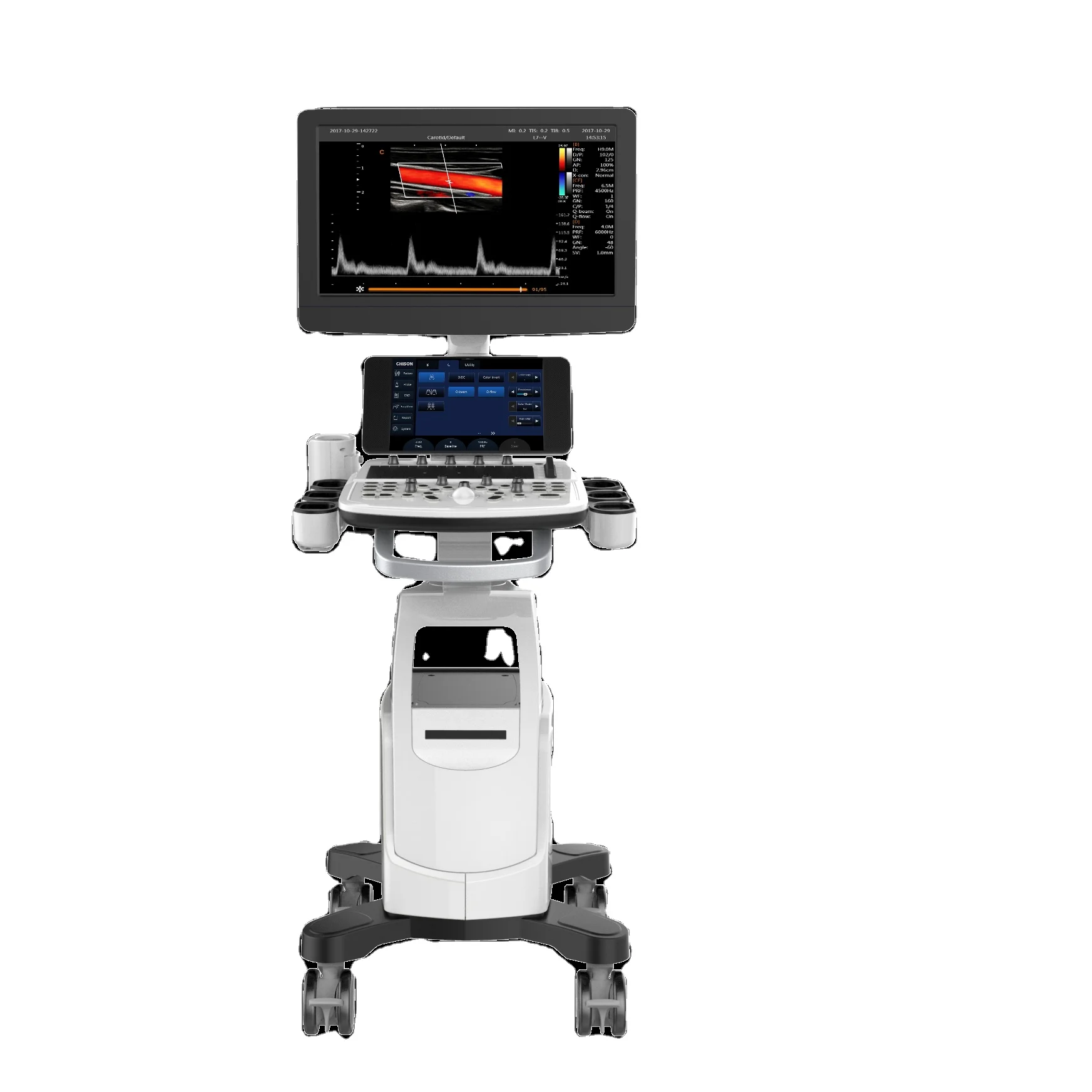 Chison Cbit 4D Color Doppler USG & Experts within Touch