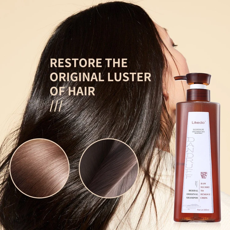 Customization Private Label for Anti-dandruff Problem High Treatment Scalp Problem Effective Anti-dandruff Hair Shampoo