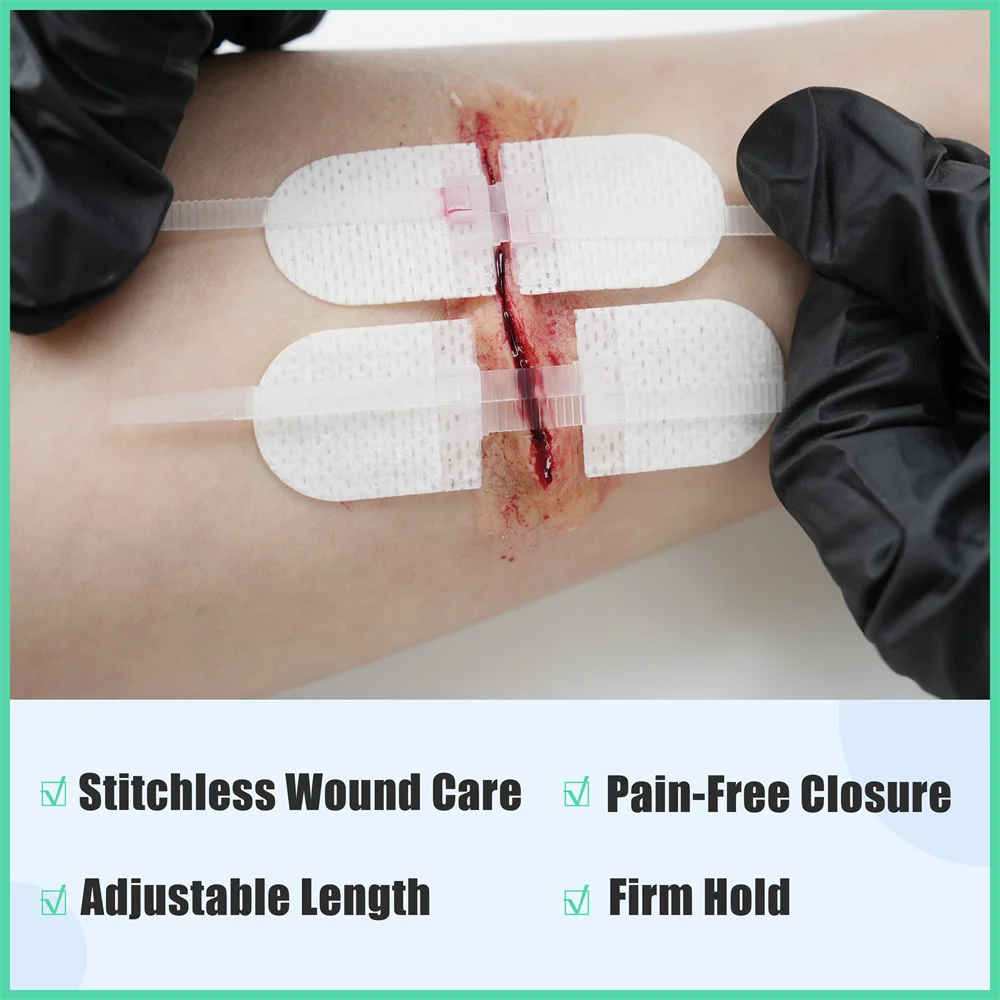 Rhino Rescue New Design Disposable Non Woven Wound Closure Device Suture Free Irreversible Zipper Wound Closure Kit