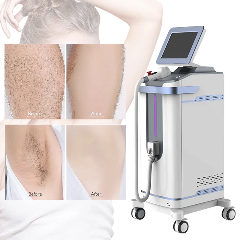808Nm Diode Laser Hair Removal Machine for Sale at Wholesale Price Commercial Laser Spa Equipment Salon For Sale