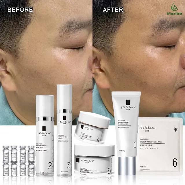 skin care products made in korea  day & night face lotion beauty facial anti acne aging skin care set