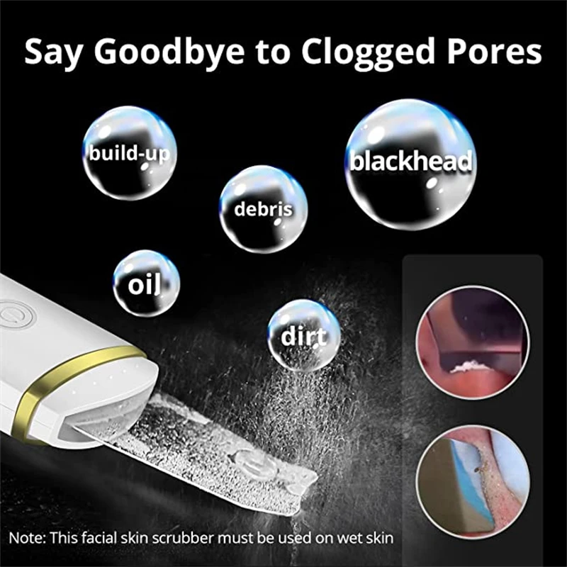 Новое поступление инструменты для ухода за кожей шпатель кожи глубокое очищение удаление черных точек очиститель пор ультразвуковой