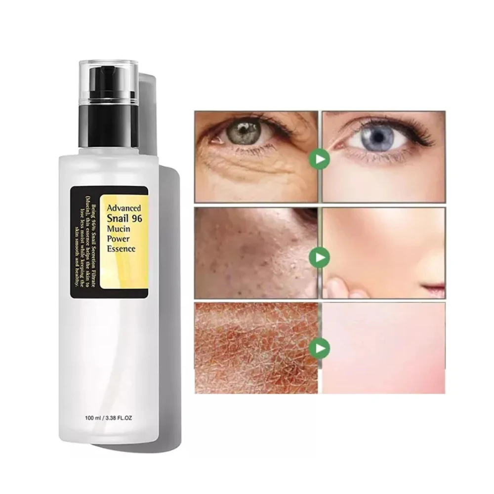 Advanced Snail 96 Mucin Power Essence 100ml Snail Secretion Filtrate 96.3% for Anti-aging Nourishing Wrinkle Improvement