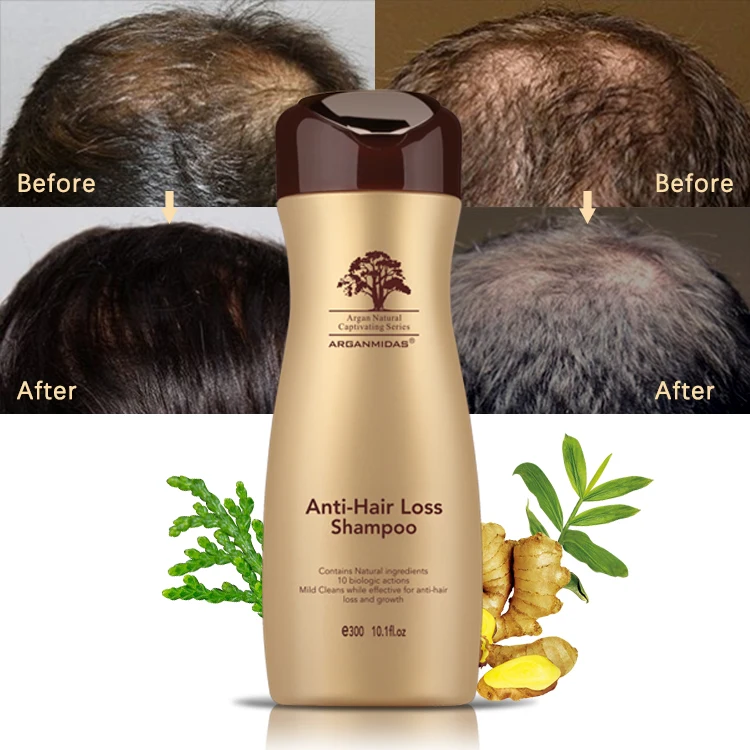 Private Label Hair Regrowth Essential Hair Growth Anti Hair Loss Shampoo