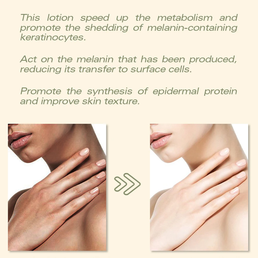 Herbal Formula For Whitening And Bleaching Organic Cream Nourishing Whitening Body Of America