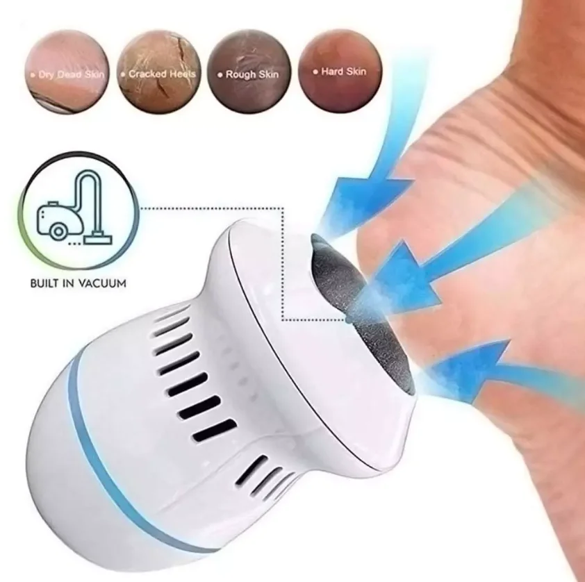 Portable USB Rechargeable Foot File Pedicure Tools Feet Care Vacuum