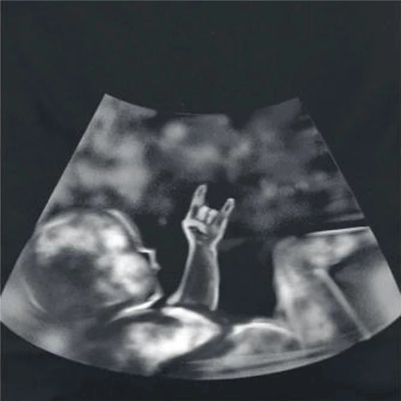 Оптовая продажа OEM рубашка для беременных раскрывающая беременность B Scan Детский принт Новые Топы для беременных мам Забавные милые рубашки новые подарочные футболки для мам