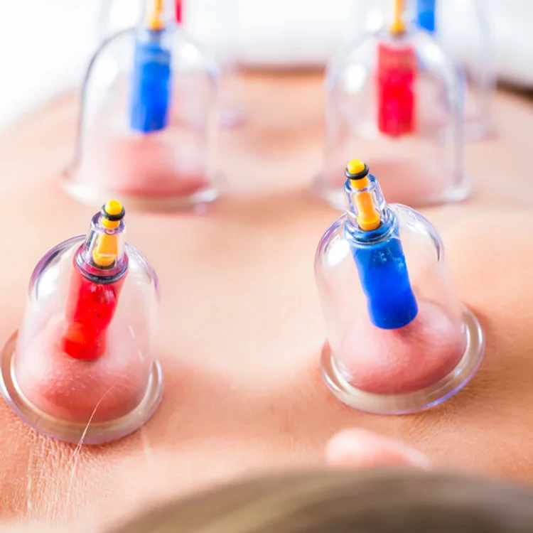 ventosas maquina ventosas para adelgazar cupping  vacuum cupping manufacturers hijama massage