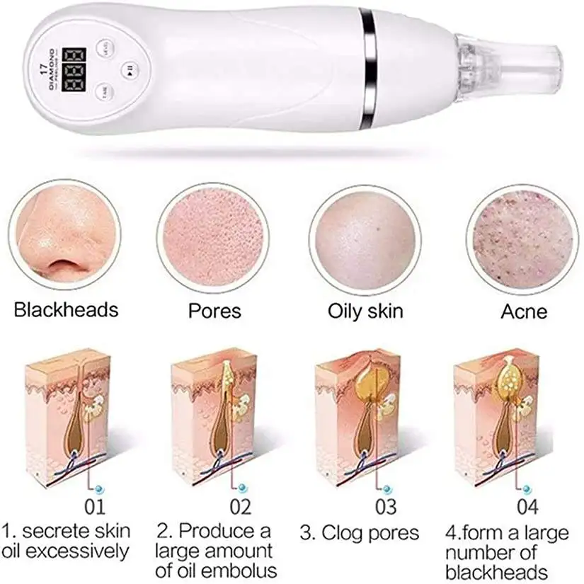 Blackhead Remover Vacuum Suction Facial Comedo Acne Remover Nose And Face Vacuum Pore Cleaner Blackhead Remover