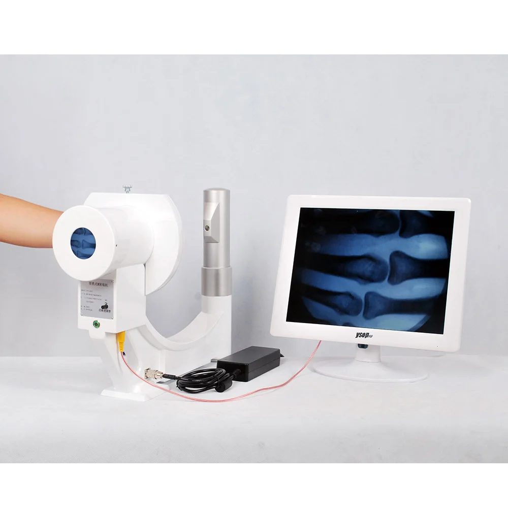 MSLPX37 High quality 15 inch display Veterinary portable X ray machine
