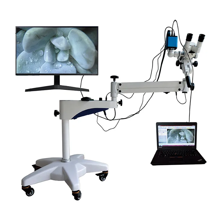 Colposcope High Resolution Colposcope Video Camera Optical Lens Binocular Vision