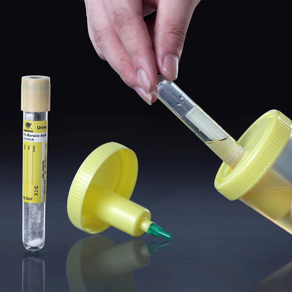 Vacuum 12 ml disposable plastic urine test collection tube with push cap