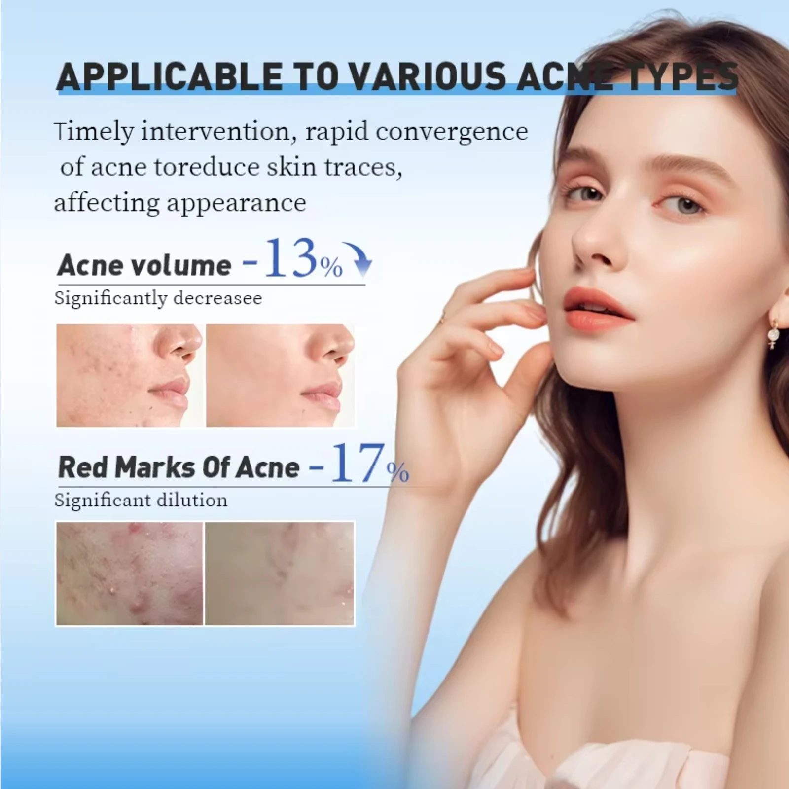 Private Label Natural Sun Protection Skin Moisturizer Whitening Anti Aging Kojic Acid Face Cream For Women