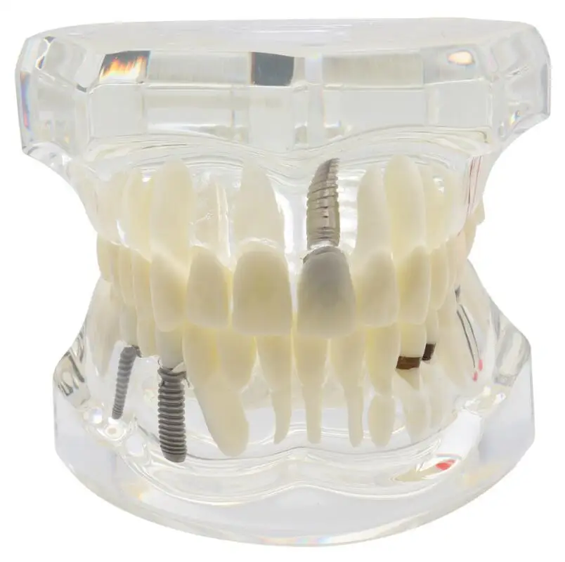  Dental orthodontic prosthetic removable ADC teaching model kit of 32 teeth