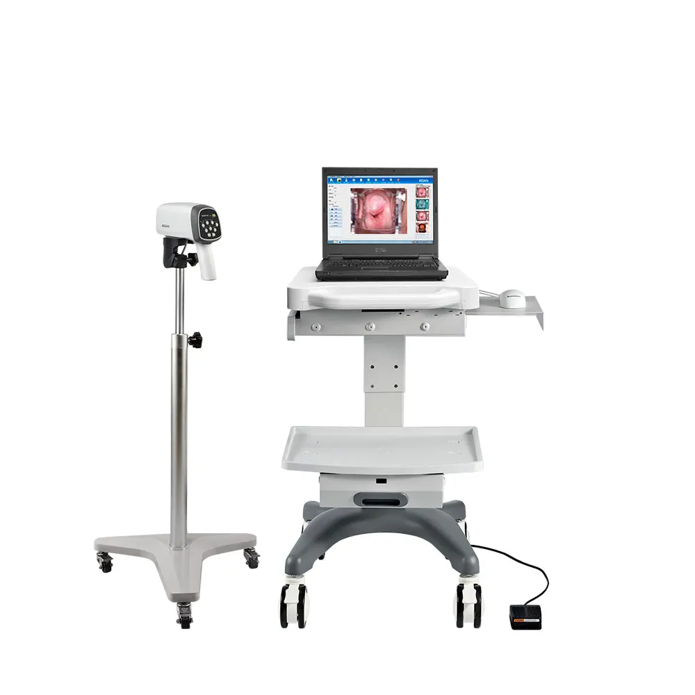  Оригинальное HD видео Colposcope EDAN C3A C6A цифровое colposcopio edan colposcope