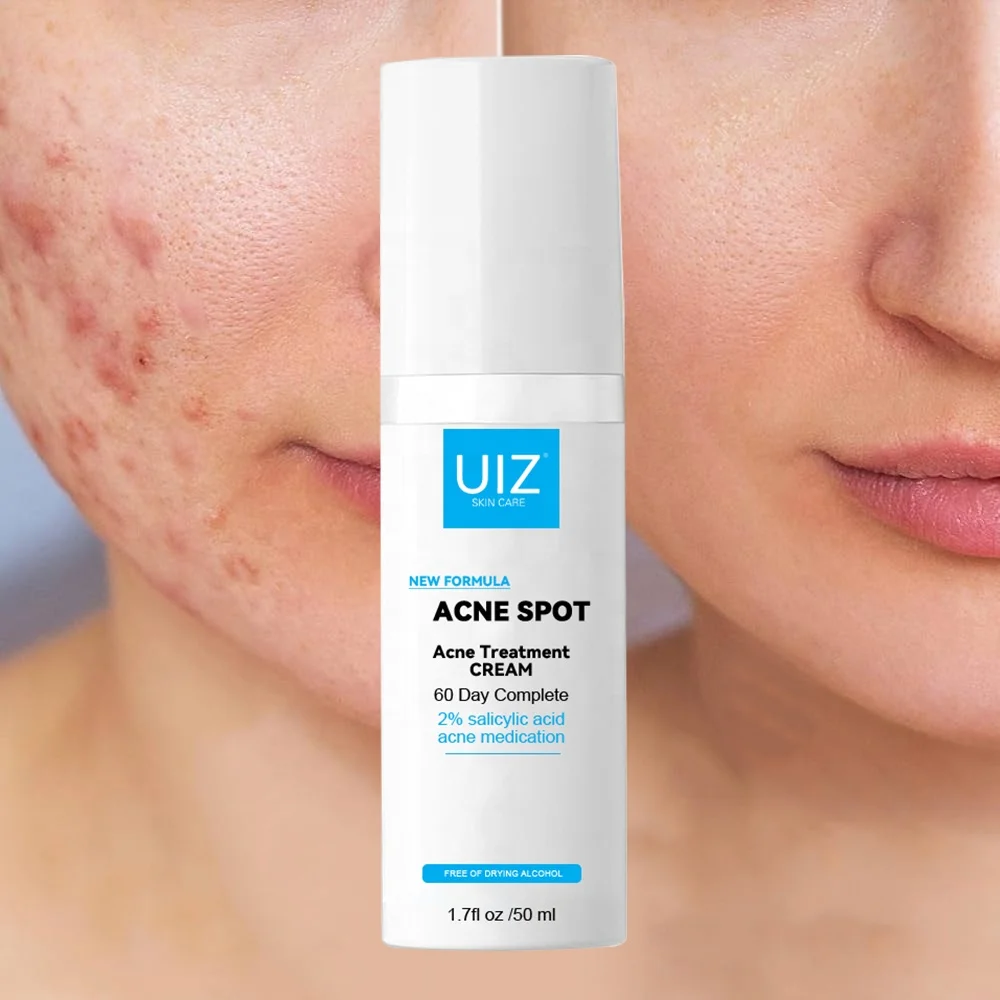 Private Label Natural Acne Cream Skin Care Repair Anti Acne Pimple Removal Salicylic Acid Cream