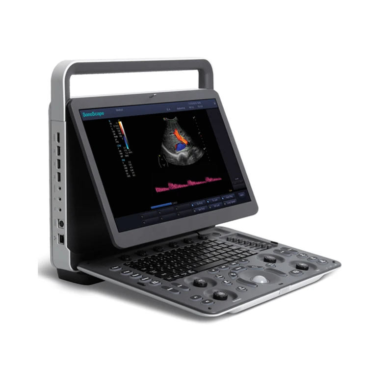 3D 4D Full Digital Doppler Ultrasound Scan Machine /Scanner CE Approved Sonoscape E1EXP Ultrasound Machine