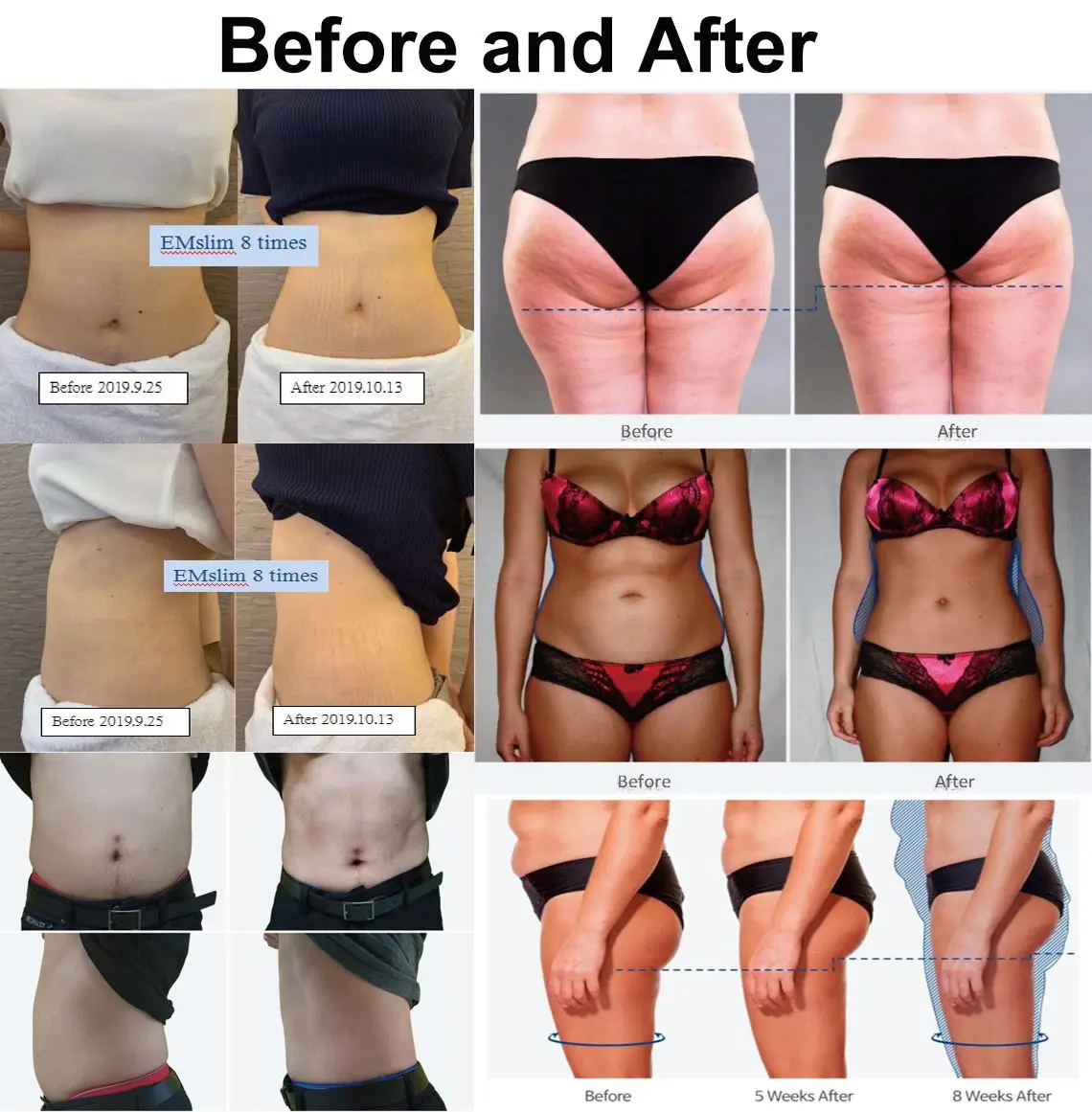 
slim beauty tesla machine electromagnetic muscle stimulator EMS body sculpture slim beauty machine 