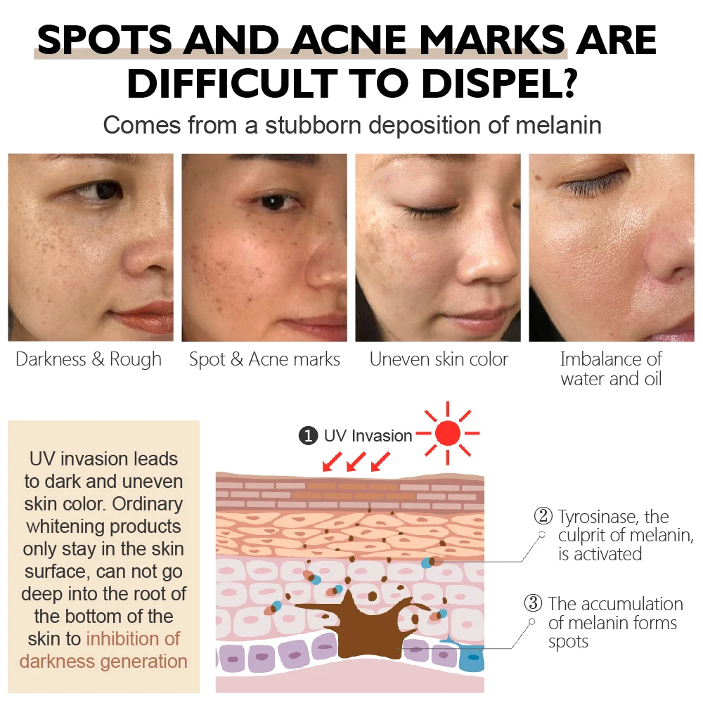 VIBRANT GLAMOUR Brighten Moisturizing Reduce Dullness Spot Acne Marks Facial Skin Care Arbutin Whitening Toner