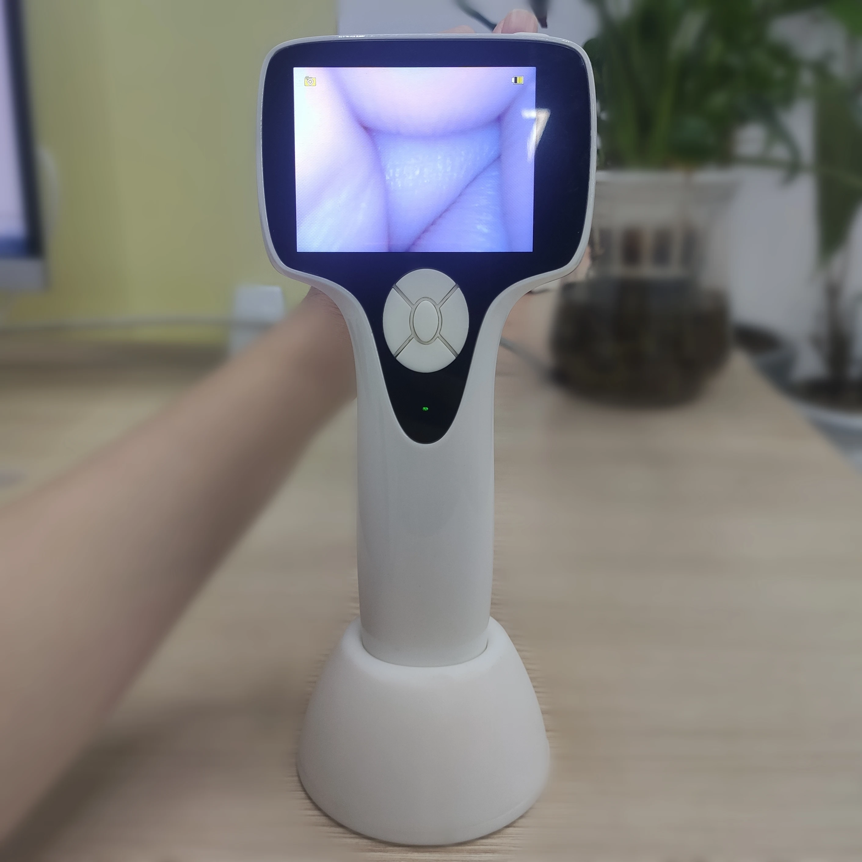 BESDATA manufacturers digital smart camera endoscope mini video otoscope de diagnostic prices for pediatric adult