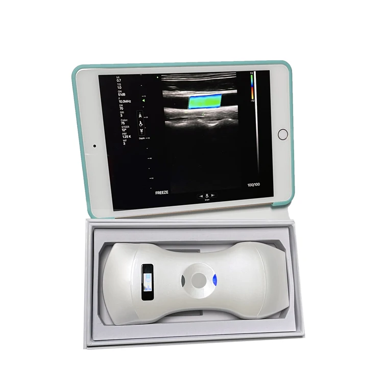 3 in 1 Handheld Portable 192 Element Phased Array Cardiac Linear & Convex Color Doppler Ultrasound Scanner Price Cheap