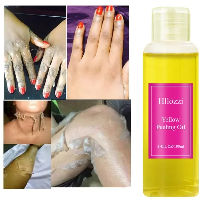 Most Effective Solution For Elbows Knees Hand Exfoliating Bleaching Whitening Dark Skin Super Strength Yellow Peeling Oil