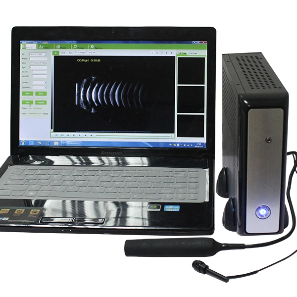 Ophthalmic A/B Scanner Ultrasound machine SAB-200