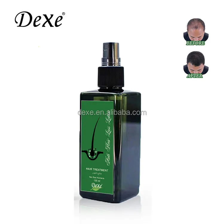 Dexe herbal instant hair grow spray hair growth men and women wholesale anti hair loss lotion