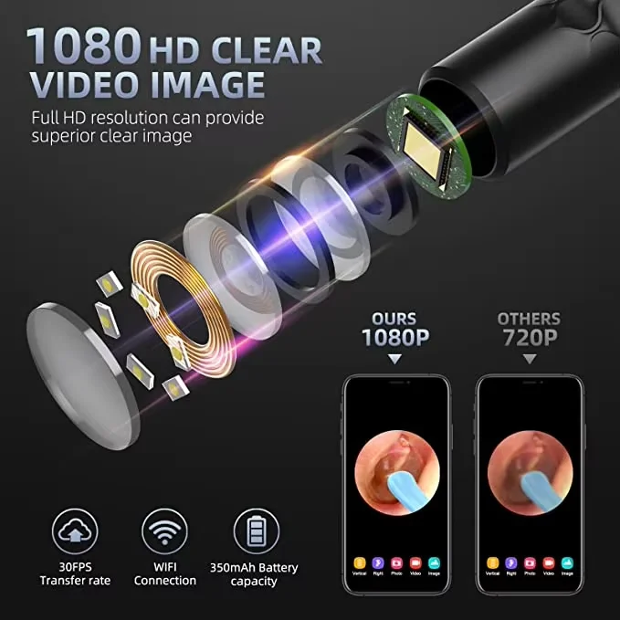 A-Beauty rechargeable LED light electric earwax removal endoscope earwax remover with HD camera WiFI connection