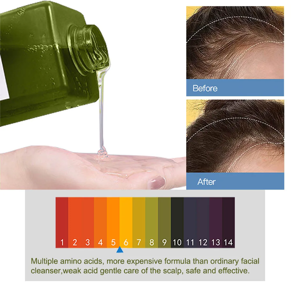 Shampoo Hair Care Anti-Loss Control Oil 100% Natural Amino Acid Ginger Baby And Pregnant Shampoo And Conditioner Hair Care Sets