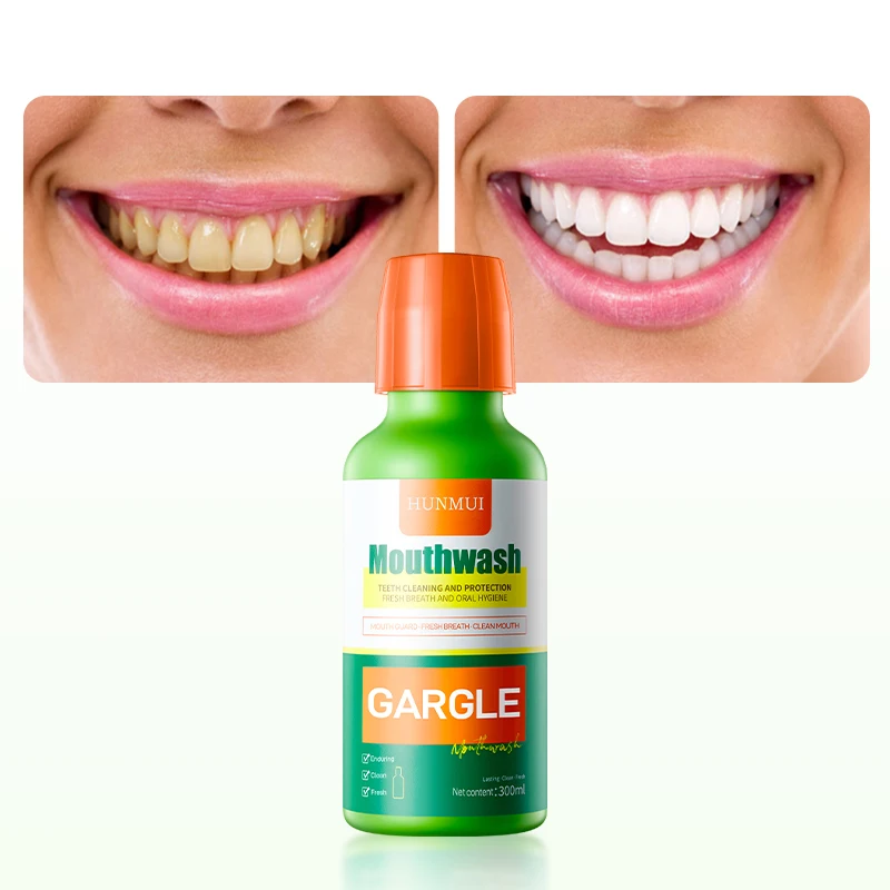 Daily Oral Health Oral Cleaning Antibacterial Breath Fresh Whitening  Liquid Mouthwash