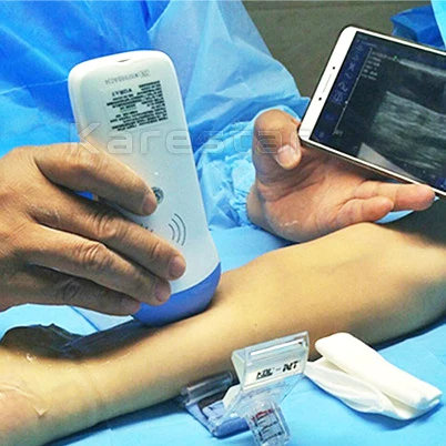 128 elements full digital handheld USG machine pet use wireless probe ultrasound