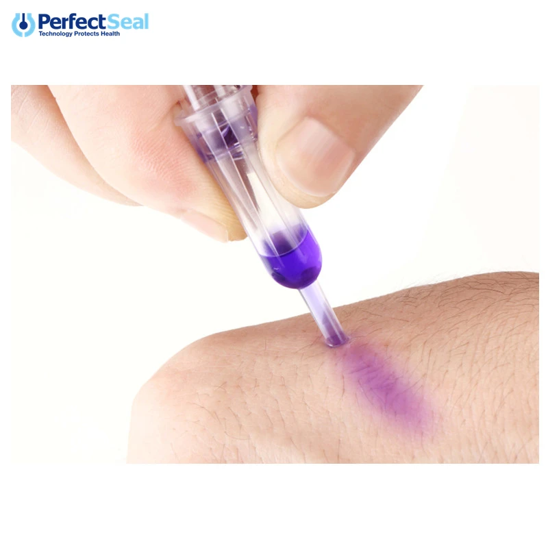 Best skin glue surgical tissue adhesive for wound closure