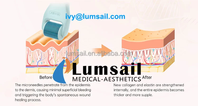 bio-roller-G10_XQ_006 s.jpg