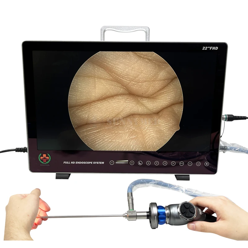 SY-PS050 Portable HD Endoscopy Camera Medical Imaging Equipment  ENT Laparoscopy Hysteroscopy Urology Endoscope Camera