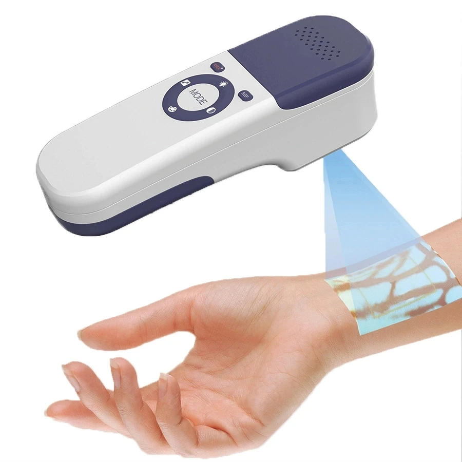 Professional Factory Portable Handheld 500 Vein Finder with High Quality