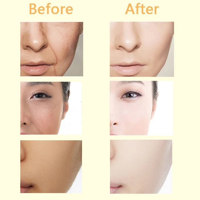 Custom Vitamin C Face Serum Paraben-free Hydrating & Moisturizing and Hyaluronic acid & Aloe Vera 24k Gold Serum Anti aging Face