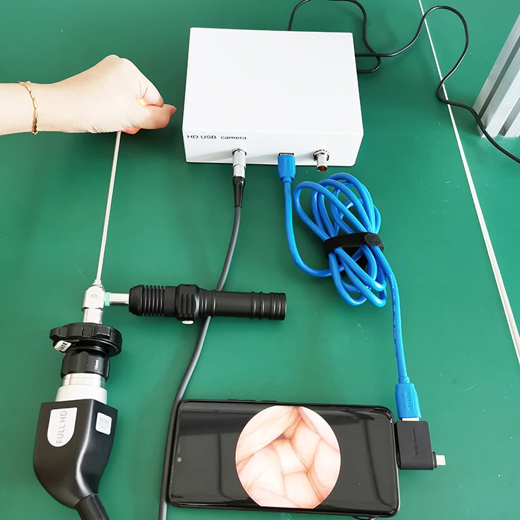 medical portable USB ear nasal scope endoscopy camera for ent surgery