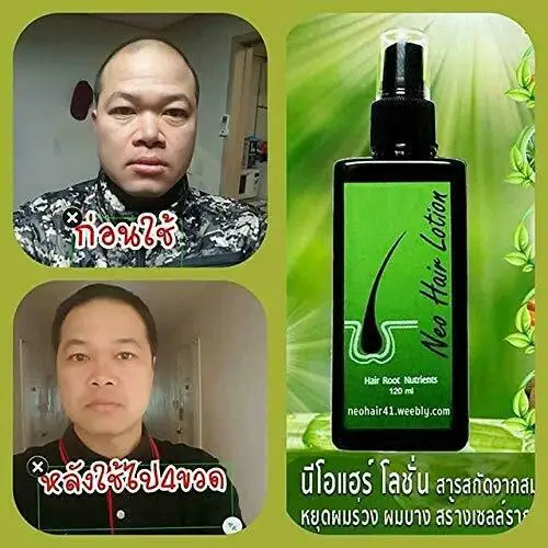 Данное средство, вылечит вас от облысения Таиланд отрастания волос лосьон сыворотка головы укрепление Neo лосьон для роста волос спрей