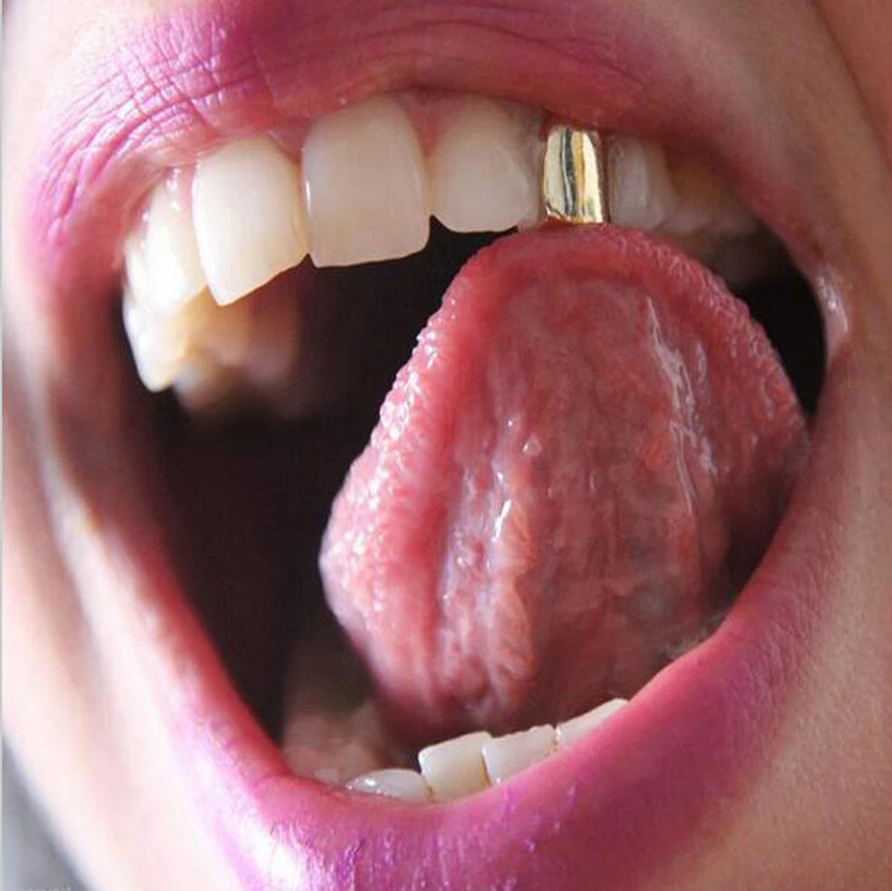 Hip Hop Nickel Free Safe Wear Premade Dental Teeth Grills Gold Plated Single Silver Top Tooth Grillz