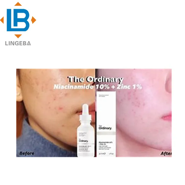 LGB new items liquid type NanoActive Salicylic acid SA no irirtation  water oil soluble